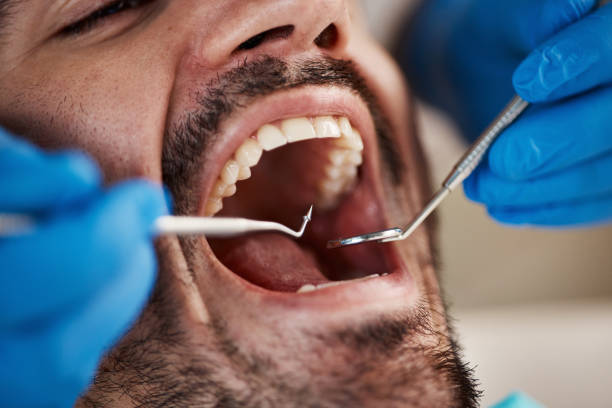 Best Pediatric Emergency Dentist in Cleora, OK