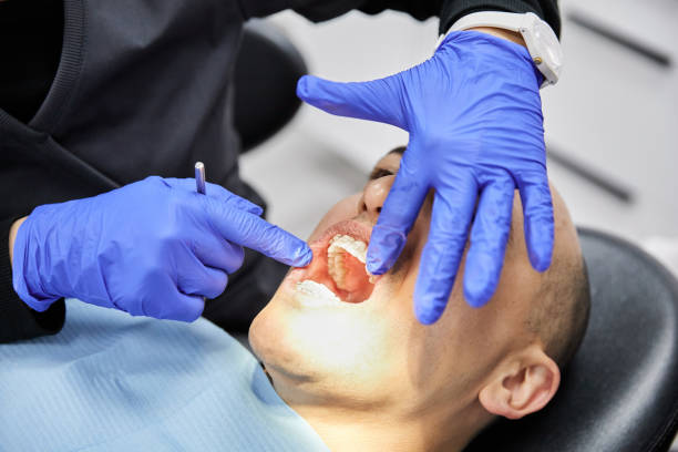 Best Emergency Tooth Extraction in Cleora, OK